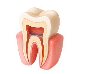 Лечение десен и каналов